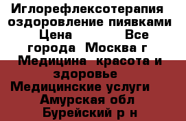 Иглорефлексотерапия, оздоровление пиявками › Цена ­ 3 000 - Все города, Москва г. Медицина, красота и здоровье » Медицинские услуги   . Амурская обл.,Бурейский р-н